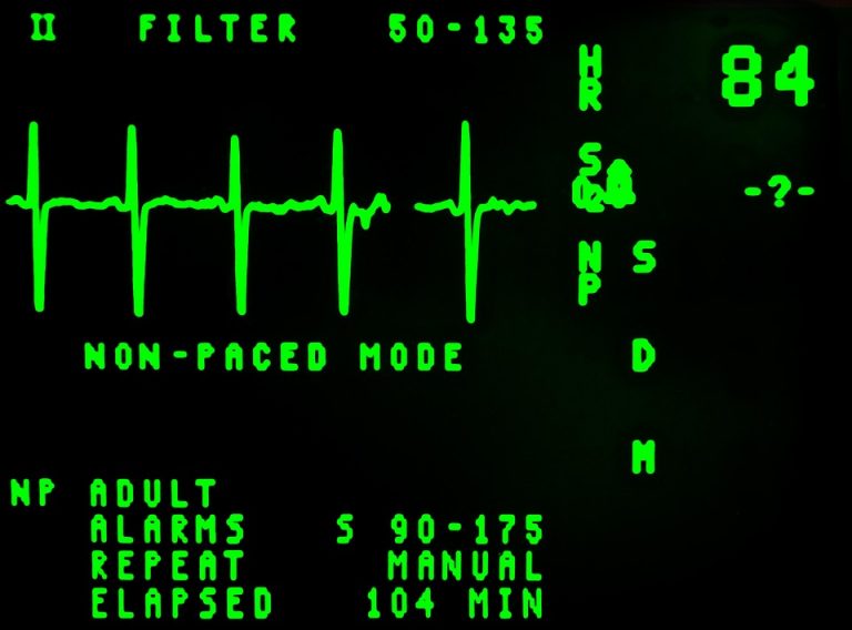 7 High-Frequency Trading Signals You Can't Ignore